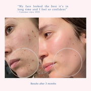 Glow Up - Face Gel Serum 1 fl. oz. (30ml)