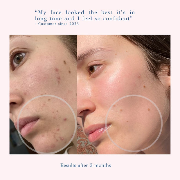 Glow Up - Face Gel Serum 1 fl. oz. (30ml)